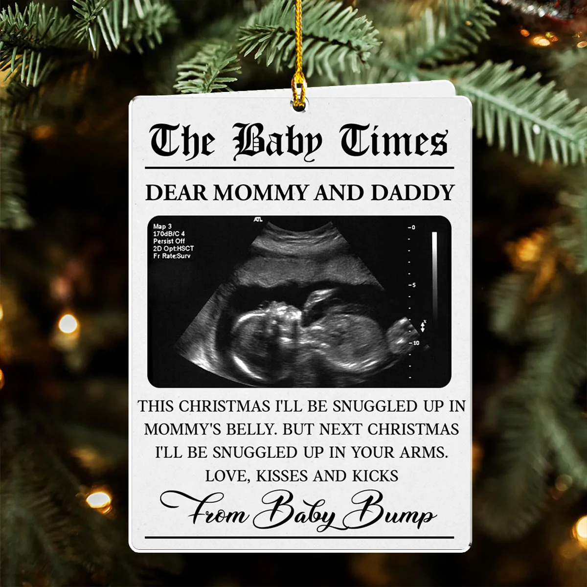 The Baby Times - Personalized Custom Acrylic Ornament - Image 3